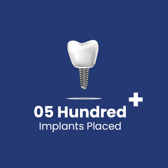 Implants Yashasvi Dental Care