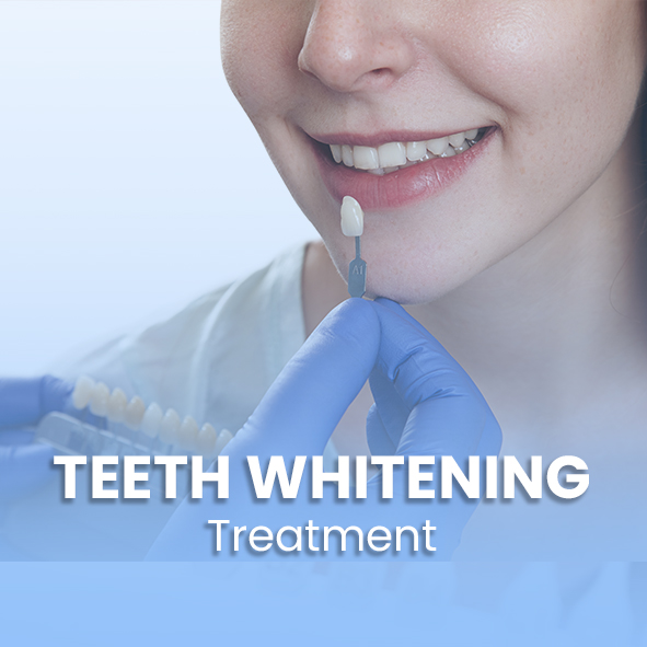 Teeth whitening at yashasvi dental care