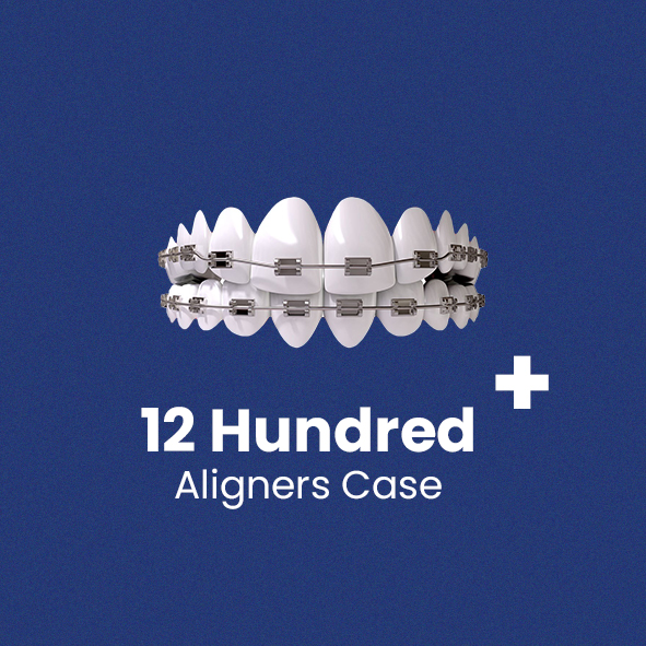 aligners of yashasvi dental case